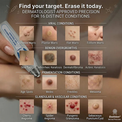 ✨Evolvion® 𝟕-𝐃𝒂𝘆 𝐒𝗸𝐢𝐧 𝐓𝒂𝗴 & 𝐒𝐩𝙤𝐭 𝐄𝐫𝒂𝐬𝙚𝐫 Painless & Scar-Free Advanced Imperfection Remova𝗜 Ro𝗜𝗜erba𝗜𝗜 Pen 🌿