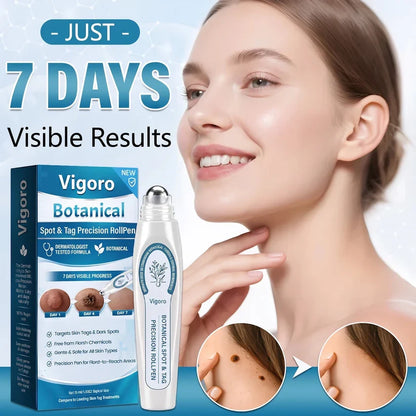 ✨Evolvion® 𝟕-𝐃𝒂𝘆 𝐒𝗸𝐢𝐧 𝐓𝒂𝗴 & 𝐒𝐩𝙤𝐭 𝐄𝐫𝒂𝐬𝙚𝐫 Painless & Scar-Free Advanced Imperfection Remova𝗜 Ro𝗜𝗜erba𝗜𝗜 Pen 🌿